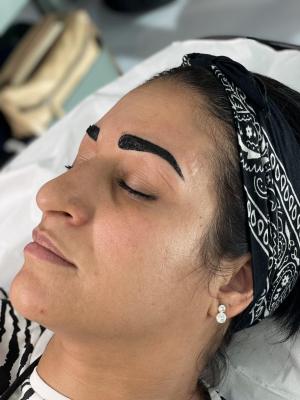 restructuration sourcils