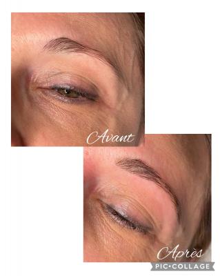 restructuration sourcils