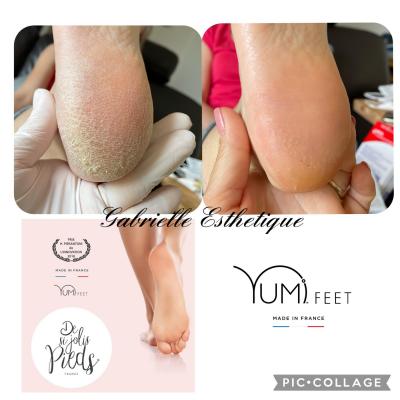 yumi feet gabrielle esthetique