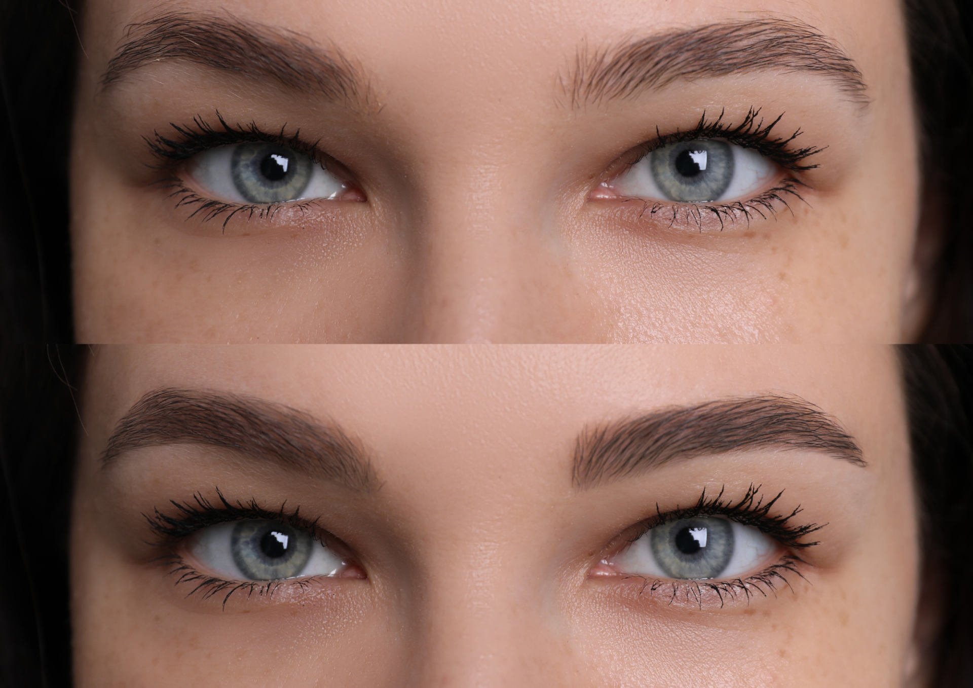 restructuration sourcils